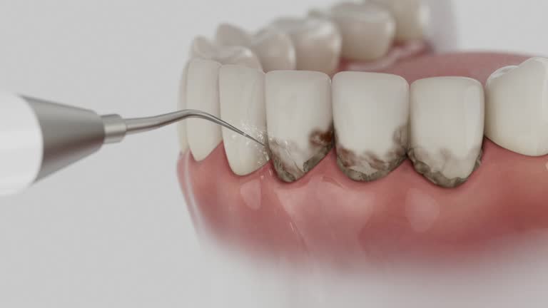 Reliable Dental contractor in Spurgeon, TN by Dentist Open Now